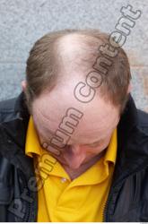 Head Hair Man White Casual Chubby Overweight Bald Street photo references